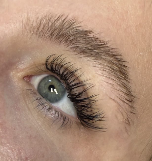 Extension set on a green eye